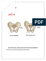 FRACTURAS DEL ANILLO PELVIANO