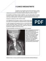 Caso Clinico Mediastinitis