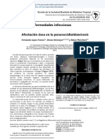 Paracoccidiomicosis 1 ES