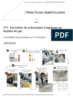 P11 - Escrutinio de Anticuerpos Irregulares en Tarjetas de Gel