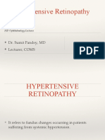 Hypertensive Retinopathy