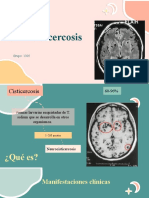 Diagnostico de Neurocisticercosis