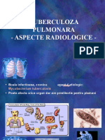 ATrofor_Tuberculoza pulmonara-aspecte radiologice