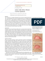 Nasal Cauterization With Silver Nitrate For Recurrent Epistaxis