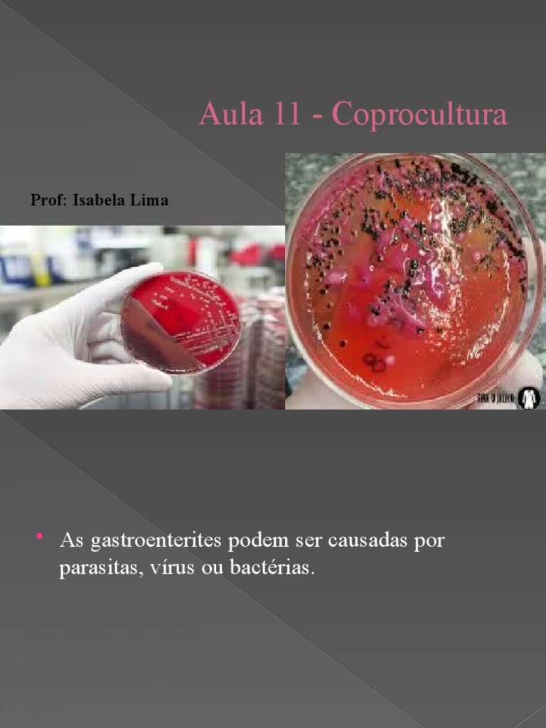 Aula 11 - Coprocultura | PDF | Meio de cultura | Biologia