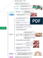 Tecnica Alveolares Posteriores