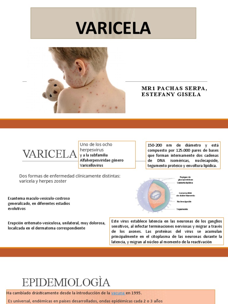 Varicela | PDF | Especialidades Medicas | Medicina CLINICA