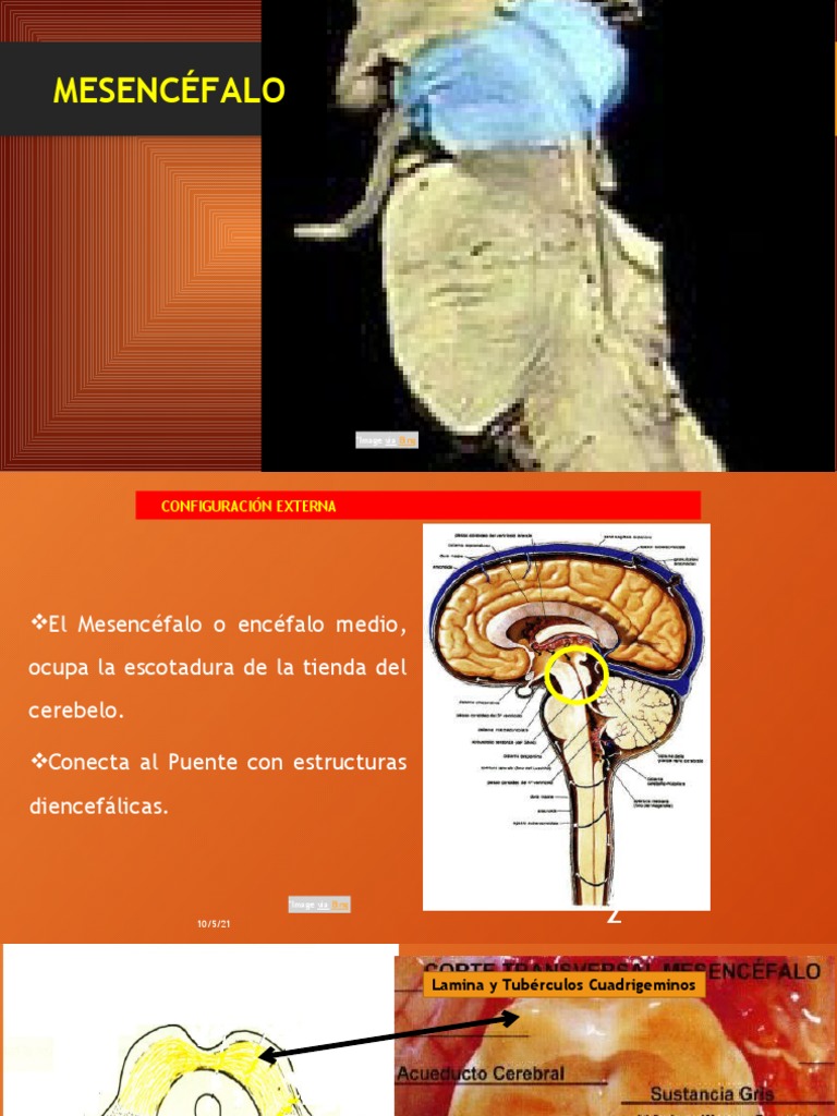Mesencéfalo | PDF | Cerebro | Anatomía