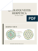 Presentacion Queratouveitis Herpetica