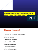 Tipos de Necrose: Padrões Morfológicos