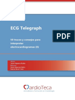 ECG Telegraph 50 trucos Cardioteca II