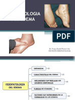 Fisiopatología - Edema