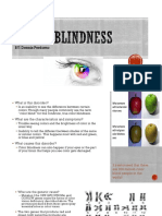 Understanding Color Blindness