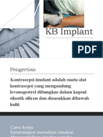 KB Implant Novi