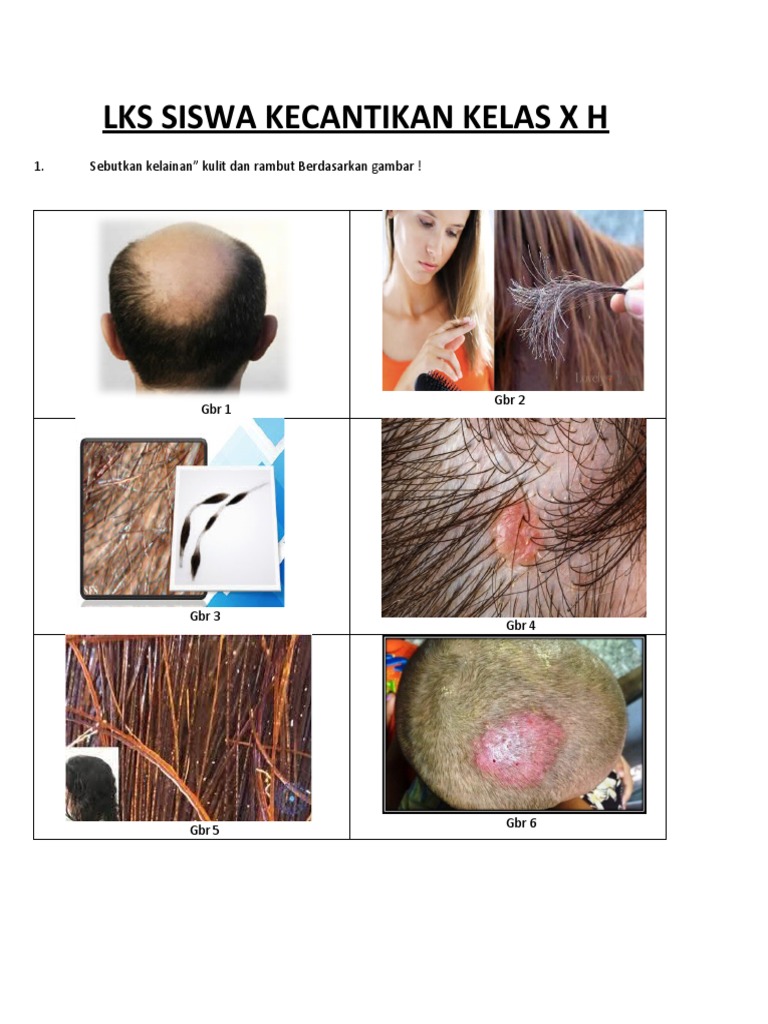 LKS Kelainan Kulit Kepala Dan Rambut | PDF