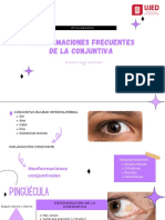 Neoformaciones Frecuentes de La Conjuntiva