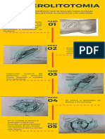 URETEROLITOTOMIA