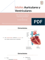 Extrasistoles A y V