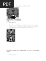 Lesões da sela Túrcica e Cisterna Supra