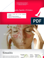 Sinusitis Aguda y Cronica