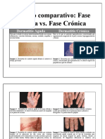 Cuadro Comparativo Sobre Dermatitis Aguda y Crónica