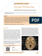 Imaging of Skull Base: Pictorial Essay: M - S - H N