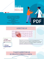 EKG-Arritmias