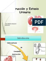 Uropatia Obstructiva