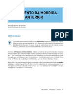 Tratamento Da Mordida Aberta Anterior