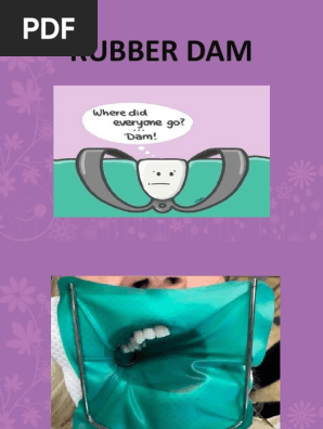 Rubber dam