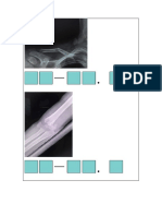 Practica de Clasificacion de Fracturas