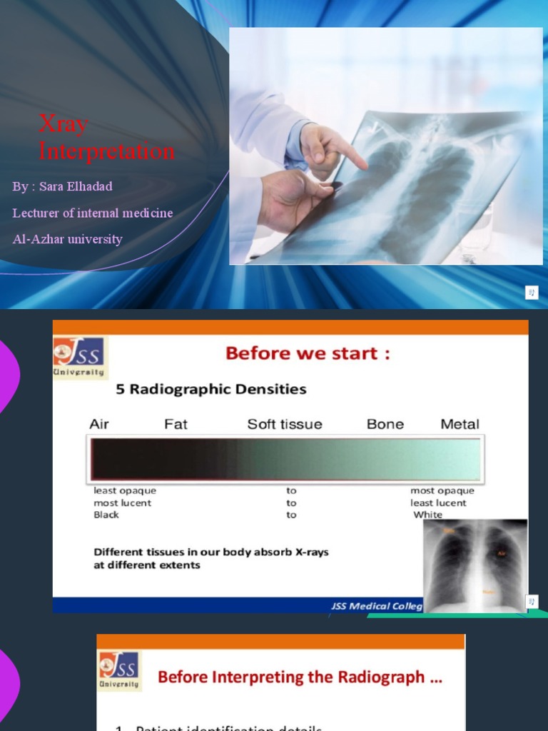 Xray Interpretation: By: Sara Elhadad Lecturer of Internal Medicine Al ...