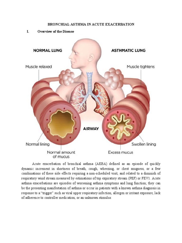 bronchial-asthma-in-acute-exacerbation-case-study-pdf-lung-asthma