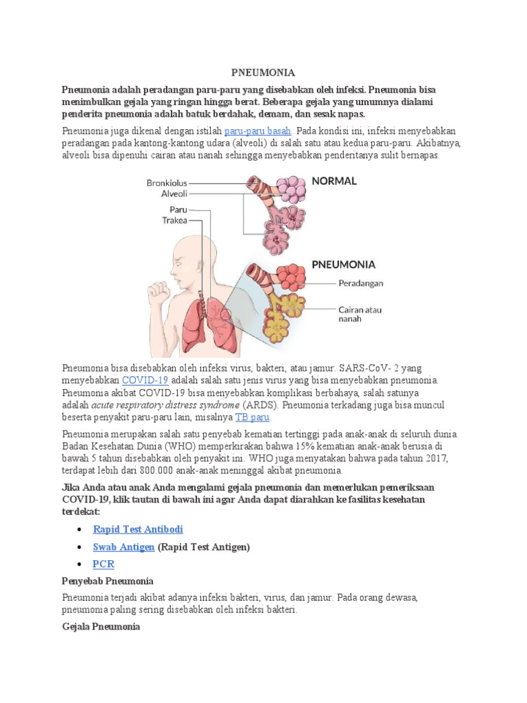 Gejala dan Pengobatan Pneumonia Anak | PDF
