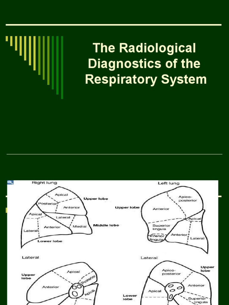 Radiological Diagnostics of Lungs | PDF | Radiography | Lung
