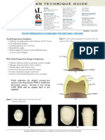 Tooth Preparation Guidelines For Zirconia Crowns
