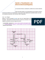 Electro Cardio Gram