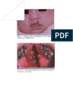 Developmental Disturbances - CPC (AmCoFam)