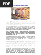 Levantamiento de Cadaver