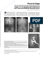 Pictorial Essay: Multidetector CT Urography With Abdominal Compression and Three-Dimensional Reconstruction