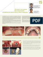 Art. Adhesión Confiable A Zirconio - Sobre Implantes