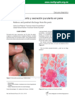 Enrojecimiento y Secreción Purulenta en Pene: Redness and Purulent Discharge From The Penis