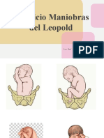 Maniobras e Leopold