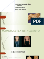 Mamoplastia OK