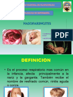 Nasofaringitis