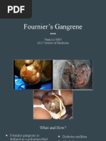 Fournier's Gangrene: Yang Lu MS3 AUC School of Medicine