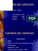 Esofago Tumores
