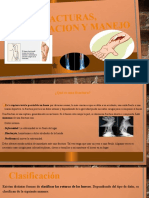 Fracturas, Clasificacion y Manejo