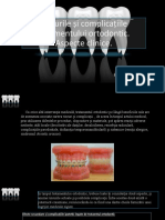 Riscurile Si Complicatiile Tratamentului Ortodontic