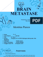 Brain Metastase
